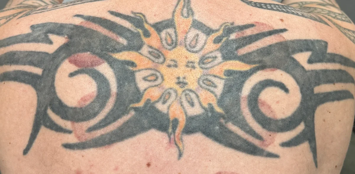 Large solid-black tribal tattoo with an orange sun across an upper back before laser removal