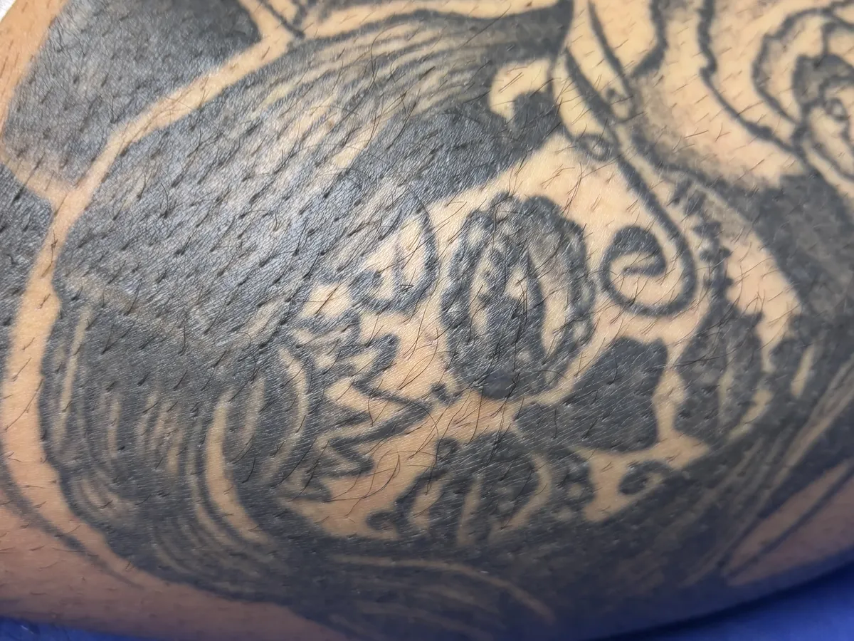 Dense solid-black tattoo covering the forearm before laser removal