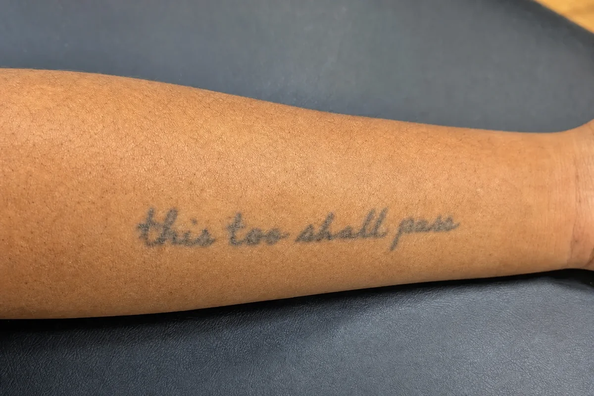 Fine black handwritten script quote tattoo along a forearm before laser tattoo removal