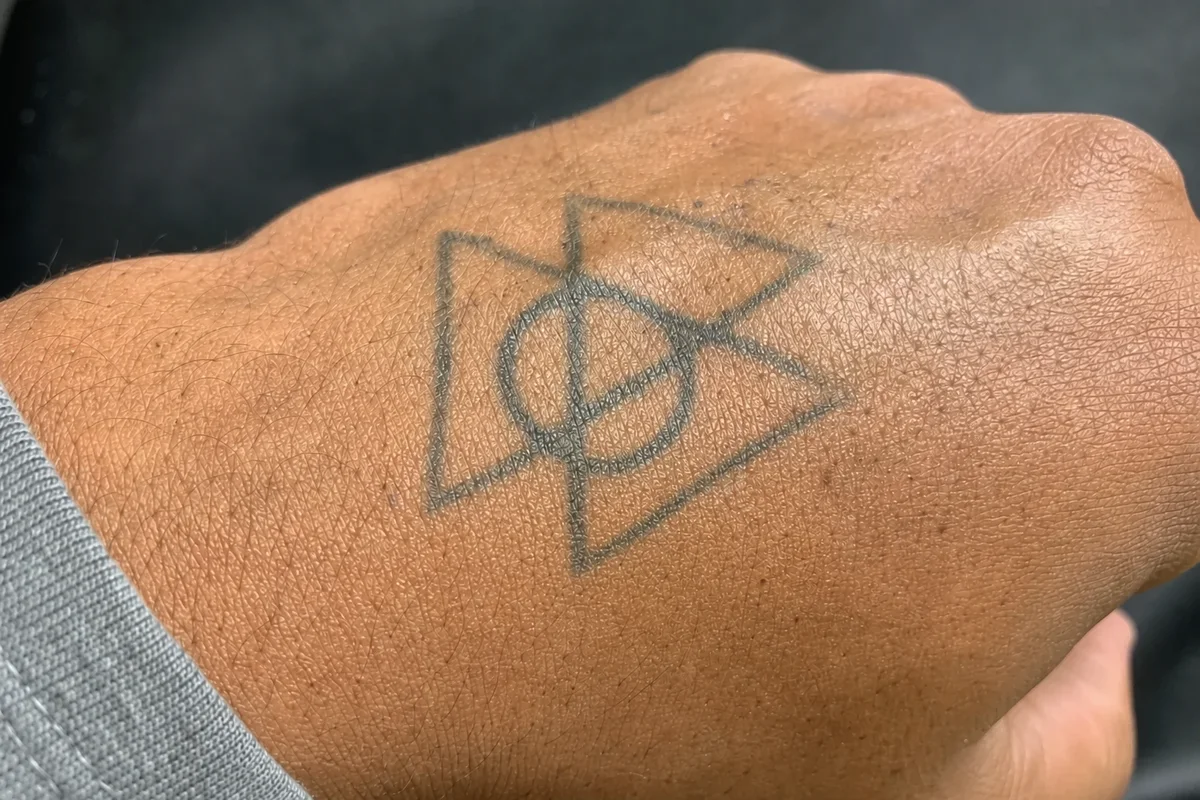 Black geometric linework tattoo on the back of a hand before laser tattoo removal