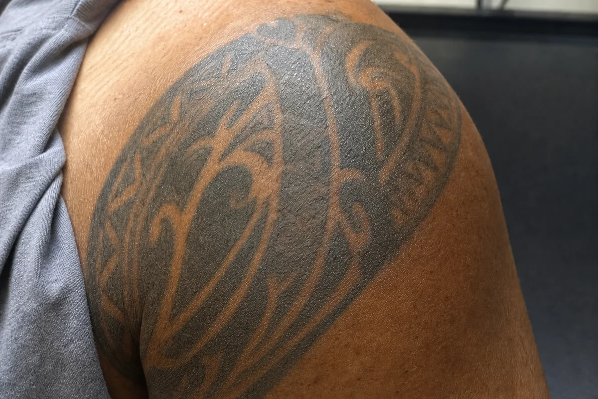 Dense solid-black tribal cover-up tattoo over a shoulder before laser tattoo removal
